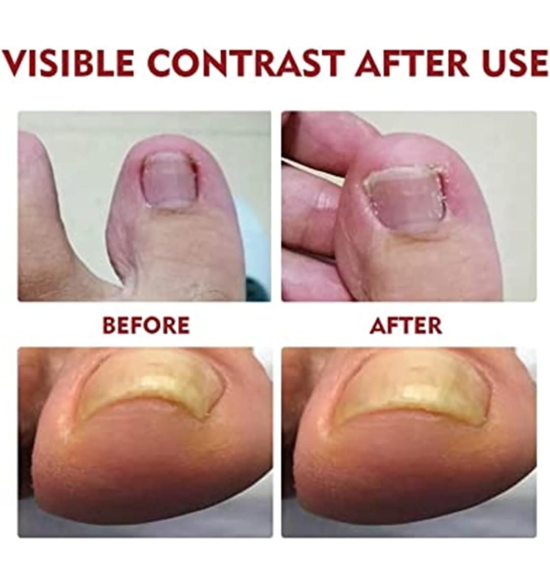 Miniatura 3 de ACEITE REPARADOR DE UÑAS